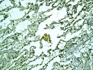 Immunohistochemical analysis of paraffin embedded Human lung tissue labelling RALBP1 with ab133549 antibody at a dilution of 1/250.