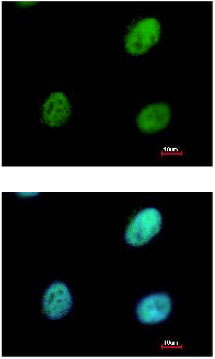 Immunofluorescent analysis of paraformaldehyde-fixed HeLa cells labeling RALY with ab153819 at 1/500 dilution. Image at the bottom costained with Hoechst 33342.