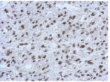 Immunohistochemical analysis of paraffin embedded U373 xenograft labeling RALY with ab153819 antibody at 1/500.