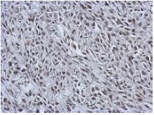 Immunohistochemical analysis of paraffin embedded RT2 xenograft labeling RALY with ab153819 antibody at 1/500.