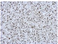 Immunohistochemical analysis of paraffin embedded C2C12 xenograft labeling RALY with ab153819 antibody at 1/500.