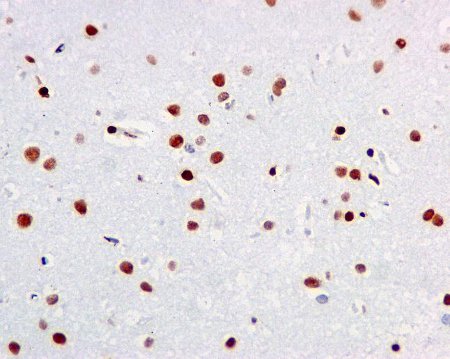 Immunohistochemical analysis of paraffin embedded Human brain tissue labeling RALY with ab170105 at a 1/100 dilution.