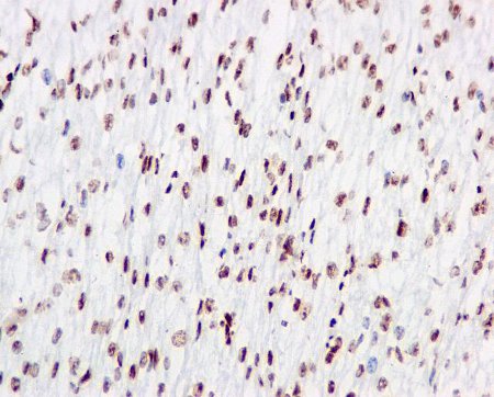 Immunohistochemical analysis of paraffin embedded Human heart tissue labeling RALY with ab170105 at a 1/100 dilution.