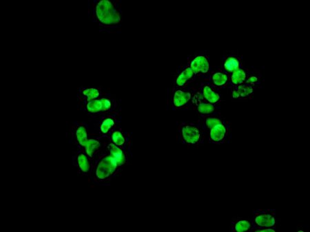 Immunofluorescence analysis of HepG2 cells labeling RALY with ab170105 at a 1/250 dilution.