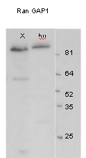 ab4784 at a 1/500 dilution staining approximately 90kDa RanGAP 1 in Xenopus egg extract (lane X, 50µg per lane) and HeLa total cell extract (lane Hu, 50µg per lane) by western blot (ECL, 1 minute exposure). NB: RanGAP 1 in the above blot is modified by the addition of the SUMO-modifier peptide, so runs at approximately 90 kDa. The smaller band visible in the Xenopus lane at approximately 60 kDa is likely to be a small amount of non-SUMOylated protein.ab4784 at a 1/500 dilution staining approximately 90kDa RanGAP 1 in Xenopus egg extract (lane X, 50µg per lane) and HeLa total cell extract (lane Hu, 50µg per lane) by western blot (ECL, 1 minute exposure). NB: RanGAP 1 in the above blot is modified by the addition of the SUMO-modifier peptide, so runs at approximately 90 kDa. The smaller band visible in the Xenopus lane at approximately 60 kDa&#