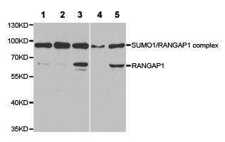 All lanes : Anti-RanGAP1 antibody (ab186849) at 1/500 dilutionLane 1 : BT474 cell extractLane 2 : HeLa cell extractLane 3 : MCF7 cell extractLane 4 : A549 cell extractLane 5 : Jurkat cell extract