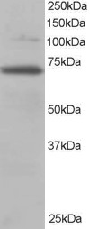ab2081 at a concentration of 0.2µg/ml staining approximately 70kda RanGAP1 in 3T3 whole cell lysate (RIPA buffer, 35µg total protein per lane) by Western blot (ECL). Primary incubation = 1 hour. 