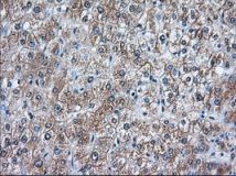 ab119092 at 1/50 dilution staining RanGAP1 in paraffin-embedded Human Liver tissue by Immunohistochemistry.