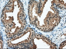 ab119092 at 1/50 dilution staining RanGAP1 in paraffin-embedded Human Prostate tissue by Immunohistochemistry.