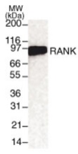RANK detection by Western blot. The analysis of RANK in 293 cells transfected with RANK cDNA. A single protein band of approximate mol. wt. of 97 kDa was detected by using anti-RANK at 2 ug/ml. 