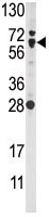 Anti-Nrf2 antibody - Aminoterminal end (ab75919) at 1/60 dilution + Ramos cell line lysates at 35 µg