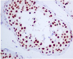 ab129008, at 1/250 dilution, staining RAPGEF5 in paraffin embedded Human testis tissue by Immunohistochemistry.