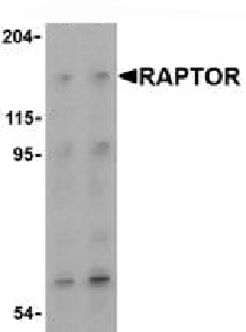Lane 1 :  Anti-Raptor antibody (ab62454) at 2 µg/mlLane 2 :  Anti-Raptor antibody (ab62454) at 4 µg/mlLane 1 : L1210 cell lysateLane 2 : L1210 cell lysateLysates/proteins at 15 µg per lane.