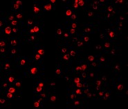 Immunofluorescence of Raptor in L1210 cells using ab62454 at 10 ug/ml.