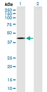 All lanes : Anti-Raptor antibody (ab169506) at 1 µg/mlLane 1 : Raptor transfected 293T lysateLane 2 : Non-transfected 293T lysateLysates/proteins at 15 µl per lane.SecondaryGoat Anti-Mouse IgG (H&L)-HRP at 1/2500 dilution
