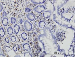 GAP antibody (ab55663) used in immunohistochemistry at 6ug/ml on formalin fixed and paraffin embedded human small Intestine.