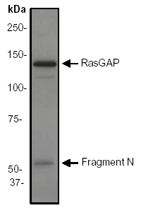 Anti-RASA1 antibody [EP536Y] (ab40677) at 1/2000 dilution + Rat brain lysate at 10 µg