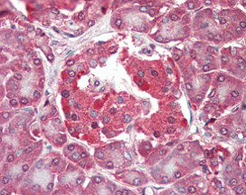 ab115516, at 2.5µg/ml, staining RASD2 in formalin-fixed paraffin-embedded Human Pancreas tissue by Immunohistochemistry, using a biotinylated goat anti-rabbit IgG secondary antibody, alkaline phosphatase-streptavidin and chromogen.