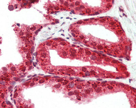 ab115516, at 2.5µg/ml, staining RASD2 in formalin-fixed paraffin-embedded Human Prostate tissue by Immunohistochemistry, using a biotinylated goat anti-rabbit IgG secondary antibody, alkaline phosphatase-streptavidin and chromogen.