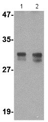 Lane 1 : Anti-RASD2 antibody (ab115516) at 1 µg/mlLane 2 : Anti-RASD2 antibody (ab115516) at 2 µg/mlLane 1 : Rat colon tissue lysateLane 2 : Rat colon tissue lysate