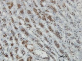 RASEF antibody (ab58046) used in immunohistochemistry at 3ug/ml on formalin fixed and paraffin embedded human adrenal gland.