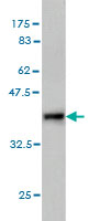 Western blot against tagged recombinant protein immunogen using ab57245 RASGEF1C antibody at 1ug/ml.