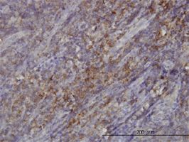 RASGRP 4 antibody (ab57978) used in immunohistochemistry at 3ug/ml on formalin fixed and paraffin embedded human tonsil.