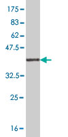 Western blot against tagged recombinant protein immunogen using ab56658 RASGRP2 antibody at 1ug/ml.