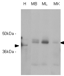 All lanes : Anti-RASSF1a antibody [3F3] (ab23950) at 1/1000 dilutionLane 1 : Hela (H) cell extractLane 2 : Mouse brain (MB) extractLane 3 : Mouse liver (ML) extractLane 4 : Mouse kidney (MK) extractLysates/proteins at 20 µg per lane.SecondaryGoat anti-mouse HRP conjugatedeveloped using the ECL technique