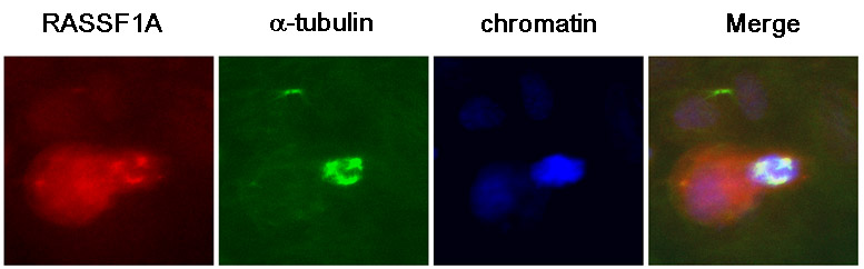 A431 cells were labeled with anti-RASSF1a(clone 3F3) ab23950. Detection was done using a biotinylated secondary antibody and Texas-red conjugated streptavidin. 