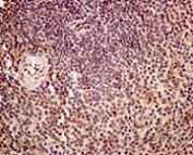 Immunohistochemical analysis of paraffin-embedded Human tonsil tissue labeling RAVER2 with ab174321 at 1/50 dilution.