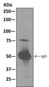 Western blot analysis on immunoprecipitation pellet from fetal lung lysate, immunoprecipitated using ab174321 at 1/10 dilution.