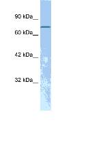 Anti-RB associated KRAB repressor antibody (ab28487) at 2 µg/ml (in 5% skim milk / PBS buffer) + Raji cell lysateSecondaryHRP conjugated anti-Rabbit IgG at 1/50000 dilution