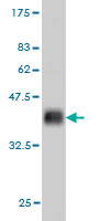 Western blot against tagged recombinant protein immunogen using ab57604 RB associated KRAB repressor antibody at 1ug/ml.