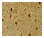 Immunohistochemical staining of mouse tissue using anti-pRb2 / p130 antiserum. The staining shows the location of pRb2 / p130 in developing mouse tissue. References for Anti-Rb2 p130 antibody (ab6545) This product has been referenced in: Herriges MJ et al. Long noncoding RNAs are spatially correlated with transcription factors and regulate lung development. Genes Dev 28:1363-79 (2014). Read more (PubMed: 24939938) » Cerezo A et al. Absence of Caveolin-1 Increases Proliferation and Anchorage-Independent Growth by a Rac-Dependent, Erk-Independent Mechanism. Mol Cell Biol : (2009). WB ; Mouse . Read more (PubMed: 19620284) » See all 3 Publications for this product Publishing research using ab6545 ? Please let us know so that we can cite the reference in this datasheet