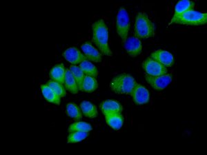 Immunofluorescence analysis of MCF7 cells, labeling RBBP9 using ab157202 at a 1/250 dilution.