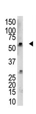 Anti-RBCK1 antibody (ab38540) at 1/100 dilution + Mouse kidney tissue lysate