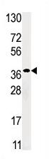Anti-RBKS antibody - Aminoterminal end (ab71451) at 1/40 dilution + HepG2 cell line lysate at 12.5 µgObserved band size : 40 kDa (why is the actual band size different from the predicted?)
