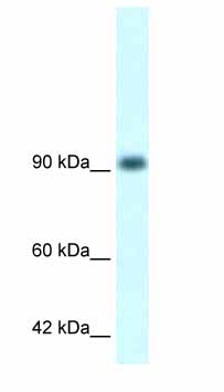 Anti-RBM10 antibody (ab26046) at 0.5 µg/ml + Daudi cell lysateSecondaryHRP conjugated anti-Rabbit IgG diluted 1: 50,000 - 100,000