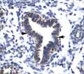 Staining of human lung tissue with ab26046 at a 4.0-8.0ug/ml dilution. Positive labelled epithelial cells of bronchiole are indicated with arrows.
