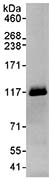 Detection of Human RBM12 by Immunoprecipitation from Whole cell lysate from HeLa cells (1 mg for IP, 20% of IP loaded), using ab72319 at 3 µg/mg lysate for IP and at 0.1 µg/ml for subsequent Western blot detection.