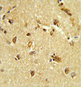 Immunohistochemical analysis of formalin-fixed, paraffin-embedded Human brain tissue labelling RBM14 with ab135773 at 1/50 dilution, followed by peroxidase conjugated secondary antibody and DAB staining.