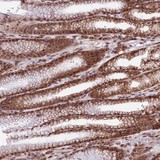 ab122515 at 1/1000 dilution staining RBM19 in Paraffin-embedded Human Stomach tissue by Immunohistochemistry. Note: moderate cytoplasmic and nuclear positivity in glandular cells.
