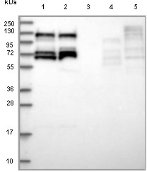 All lanes : Anti-RBM19 antibody (ab122515) at 1/250 dilutionLane 1 : RT4 lysateLane 2 : U251 MG lysateLane 3 : Human plasmaLane 4 : Human liver lysateLane 5 : Human tonsil lysatedeveloped using the ECL technique