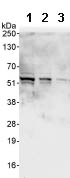 All lanes : Anti-RBM34 antibody (ab86787) at 0.1 µg/mlLane 1 : HeLa whole cell lysate at 50 µgLane 2 : HeLa whole cell lysate at 15 µgLane 3 : HeLa whole cell lysate at 5 µgdeveloped using the ECL technique