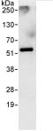 Detection of RBM34 by Western Blot of Immunprecipitate. ab86787 at 0.4 µg/ml staining RBM34 in HeLa whole cell lysate immunoprecipitated using ab86787 at 10 µg/mg lysate (1 mg/IP; 20% of IP loaded/lane). Detection: Chemiluminescence with exposure time of 30 seconds.