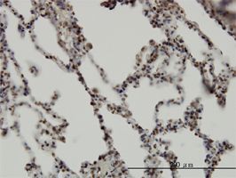 RBM5 antibody (ab56598) used in immunohistochemistry at 3ug/ml on formalin fixed and paraffin embedded human lung.