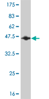 Western blot against tagged recombinant protein immunogen using ab56598 RBM5 antibody at 1ug/ml.