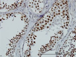 RBMXL2 antibody (ab57215) used in immunohistochemistry at 3ug/ml on formalin fixed and paraffin embedded human testis.