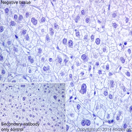 Immunohistochemical analysis of paraffin-embedded Human liver tissue with ab200202 at 1/4000 dilution followed by Goat Anti-Rabbit IgG H&L (HRP) (ab97051) at 1/500 dilution. Counter stained with Hematoxylin. Secondary antibody only control: Used PBS instead of primary antibody, secondary antibody is Goat Anti-Rabbit IgG H&L (HRP) (ab97051) at 1/500 dilution.Please note Human liver tissue represents a RBMY1A1 negative control.
